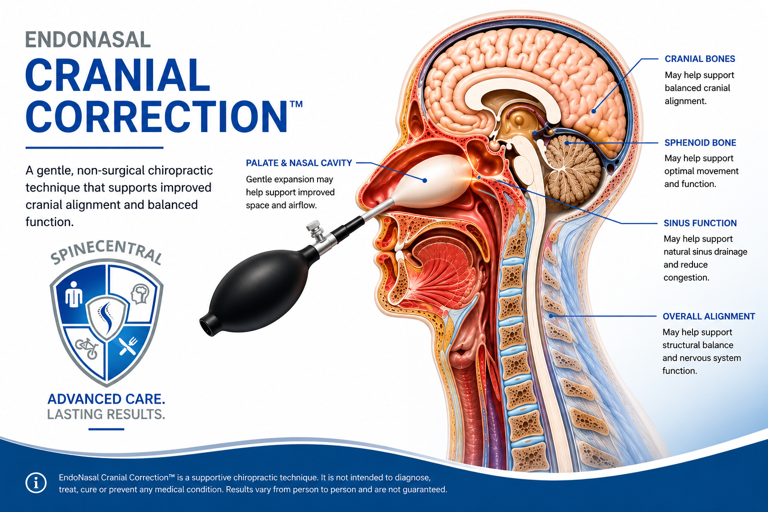Endonasal Cranial Correction being performed at SpineCentral in Hampton, London, the UK alternative to Cranial Facial Release